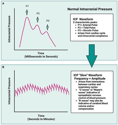 Relationship between edema and intracranial pressure following intracerebral hemorrhage in rat